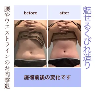 エステサロン JURISのエステ・リラクイメージ