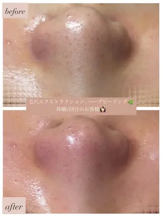 uni. abeのエステ・リラクイメージ