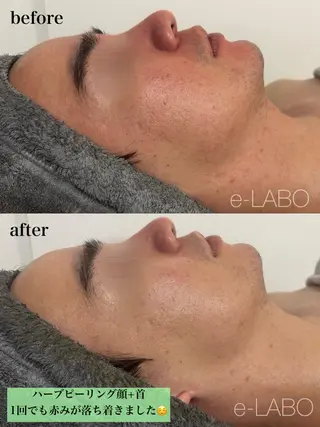 e-LABO こいずみのエステ・リラクイメージ