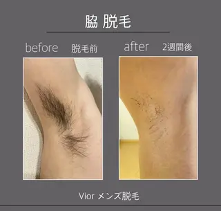 メンズ 栄 VIO Rのエステ・リラクイメージ