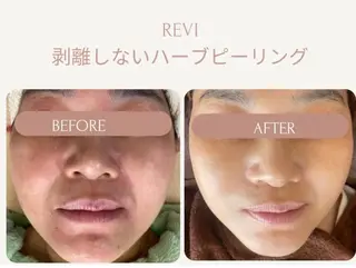 Beauty salonBellのエステ・リラクイメージ