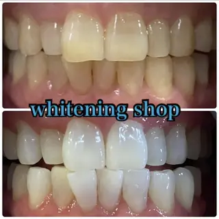 ホワイトニング ショップ千葉店のその他イメージ