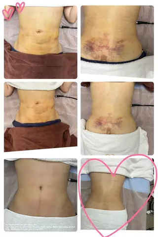 アイブロウ 新大久保成美エステ リラックぜーションのエステ・リラクイメージ