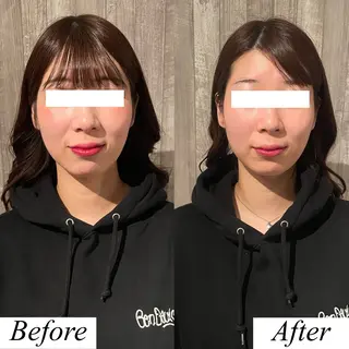 グレースフィオーレ上野御徒町店所属・頭蓋骨小顔矯正 上野御徒町店＊かんなのエステ・リラクイメージ