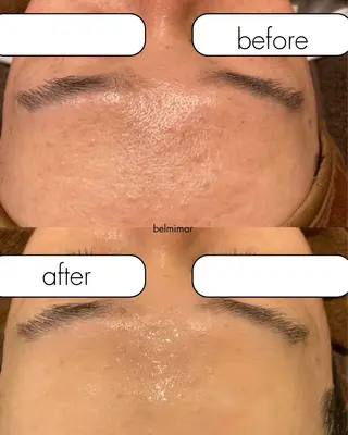 南森町・肌質改善 BELMIMARのエステ・リラクイメージ