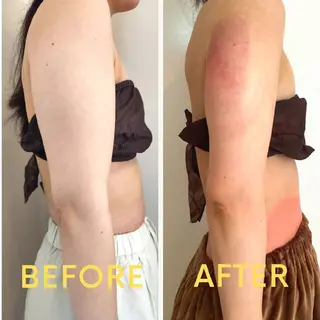 脂肪冷却・脱毛・フェイシャルサロンcoconoix [ｺｺﾉﾜ]所属・脂肪冷却・脱毛サロン coconoix のエステ・リラクイメージ