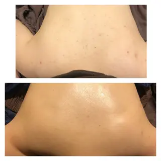 毛穴ニキビ専門 ビューティーグランツのエステ・リラクイメージ