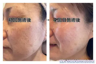 LEA MUSASHIKOSUGI所属・美肌育成サロン LEA武蔵小杉のエステ・リラクイメージ
