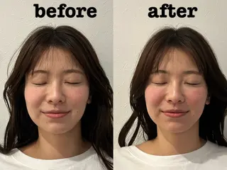 美容鍼灸Solana所属・肌質改善×美容鍼 ゆいのエステ・リラクイメージ