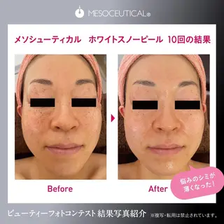 Salon de cheri サロンドシェリ人形町店所属・毛穴のお悩み・シミ 松本瞳のエステ・リラクイメージ