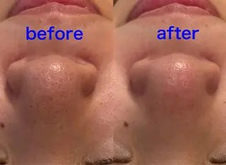 Fulala 永田のエステ・リラクイメージ