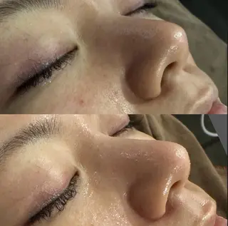 六本木脱毛andS 店長Sachiのエステ・リラクイメージ