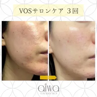 ビューティサロン aiwaのエステ・リラクイメージ