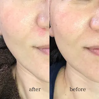 GRACIA刈谷店所属・ＧＲＡＣＩＡ 刈谷店のエステ・リラクイメージ