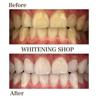 ホワイトニングショップ津店所属・ホワイトニング ショップ津店のその他イメージ