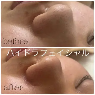 メンズ フェイシャルサロン CHIARA 荒田のエステ・リラクイメージ