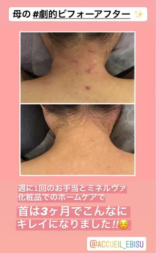 ミディアム カラー パーマ ヘアアレンジ メンズ キッズ ネイル マツエク・マツパ ニキビ・肌質改善専門 ♡人生が変わるサロンのエステ・リラクイメージ