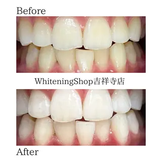 ホワイトニング ショップ吉祥寺店のエステ・リラクイメージ