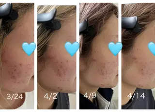 緋田 瑞穂のエステ・リラクイメージ