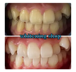 ホワイトニングショップ津店所属・ホワイトニング ショップ津店のその他イメージ