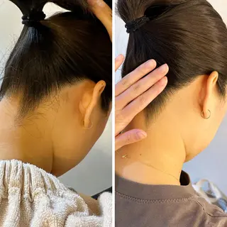 うなじ脱毛/美肌脱毛 LABELのエステ・リラクイメージ