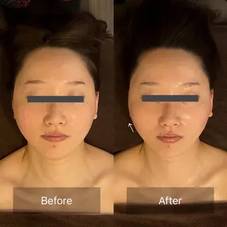 LANI所属・小顔専門サロン MAIのエステ・リラクイメージ