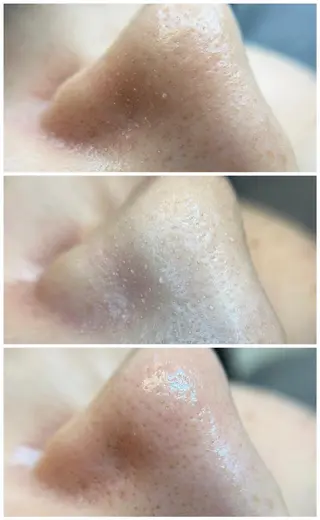 L’oeillet所属・🌊🌊__ juna__のマツエク・マツパデザイン