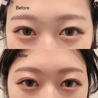 アイブロウ Tommy所属・Tommy. MIZUKIの眉毛・アイブロウイメージ