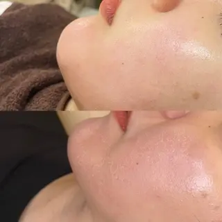 ハーブピーリング🌿 脱毛🧡ヘッドスパのエステ・リラクイメージ