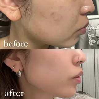 🦋美肌サロン. maho🦋のエステ・リラクイメージ