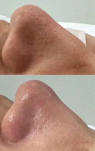 Nature Souce毛穴専門店のその他イメージ