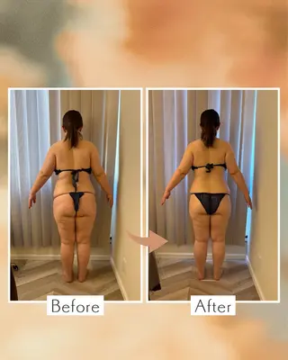 les SALON所属・大和郡山/慢性疲労 /肩こり/むくみのエステ・リラクイメージ