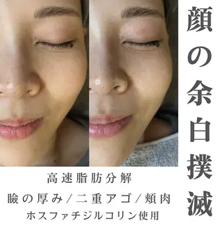 韓国肌管理ララピール クリスタルビューティのエステ・リラクイメージ