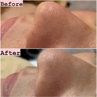 ハーブピーリング専門 muro.のエステ・リラクイメージ