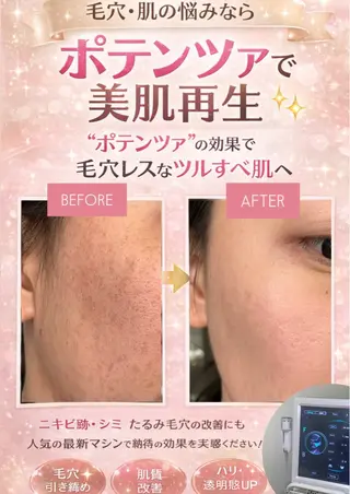 マツエク・マツパ aliaハイフ&水光ジェットサロン所属・aliaハーブ水光店 エステティシャン募集のエステ・リラクイメージ