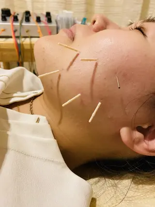 むくみたるみ専門☆ 美容鍼・小顔矯正のエステ・リラクイメージ