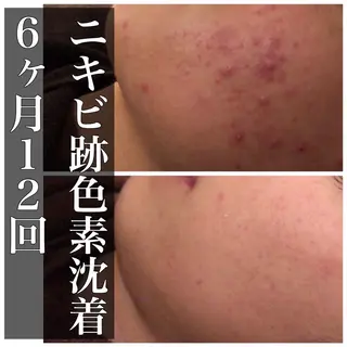 ミディアム カラー パーマ ヘアアレンジ メンズ キッズ ネイル マツエク・マツパ ニキビ・肌質改善専門 ♡人生が変わるサロンのエステ・リラクイメージ