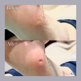 巻き爪補正店 大阪天王寺店のネイルデザイン