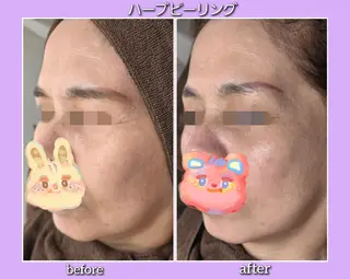 facial salon Lily所属・salon Lilyのエステ・リラクイメージ