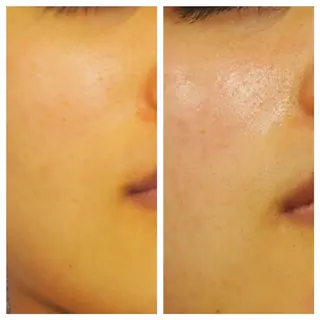 🅖🅤🅩🅔🅛 salonのエステ・リラクイメージ