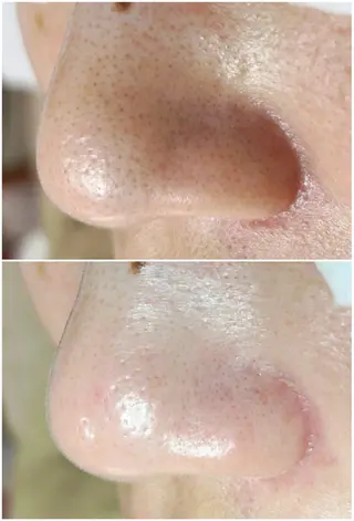 毛穴洗浄専門店/ 泉佐野/oluoluのエステ・リラクイメージ