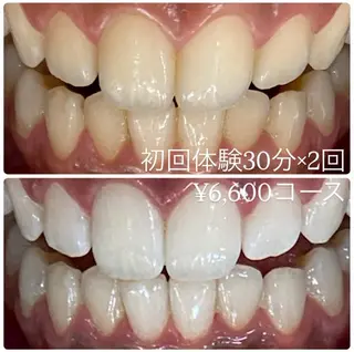 メンズ ホワイトニングルーム　川崎店所属・ホワイトニング ルーム　川崎店のその他イメージ