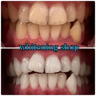 メンズ ホワイトニング ショップ川越店のエステ・リラクイメージ