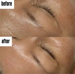 駒月 明日香のネイルデザイン