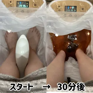 頭皮アンチエイジング L＋　秋葉原上野のエステ・リラクイメージ