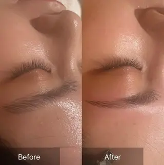 アイブロウ for woman所属・森 美優のエステ・リラクイメージ