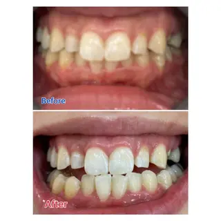 MBEAUTYSALON 千葉店・京成大久保所属・Melty 輝のその他イメージ