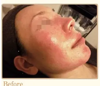 ピーリングサロン シャンテールのエステ・リラクイメージ