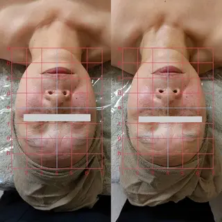 アロマトリートメントサロンmiel所属・アロマトリートメント mielのエステ・リラクイメージ