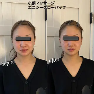 うなじ脱毛/美肌脱毛 LABELのエステ・リラクイメージ